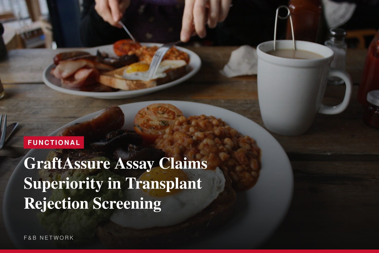 IMDX GraftAssure Assay Sets New Standard in Screening Kidney Transplant Patients Per American Journal of Transplantation
